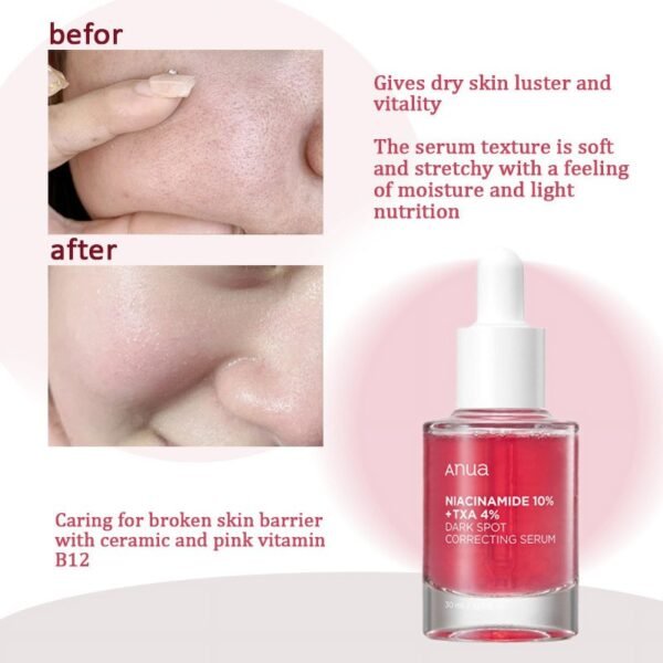 Anua 10% Niacinamide+ 4% Tranexamic Acid Serum – 30ml - Image 3