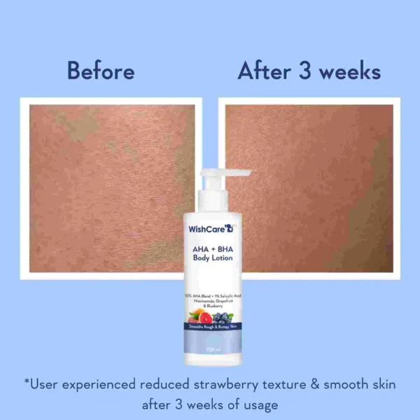 WishCare AHA + BHA Body Lotion 200ml - Image 2