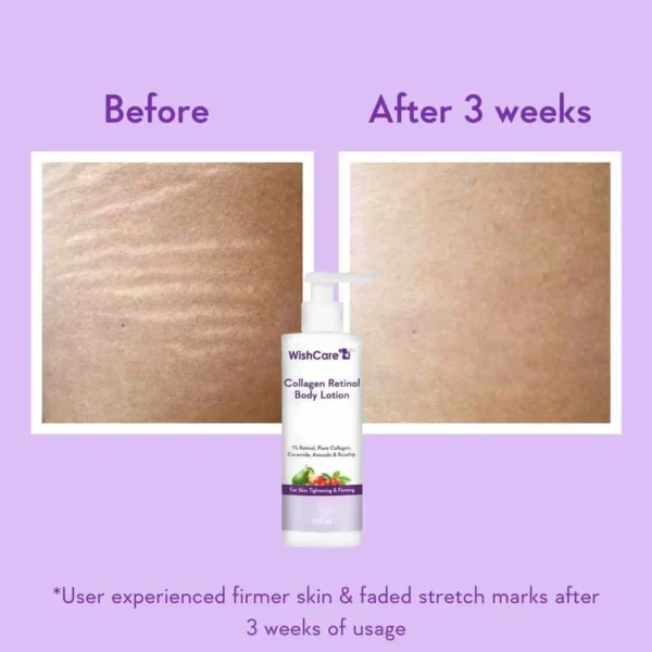 WishCare Collagen Retinol Body Lotion 200ml - Image 3