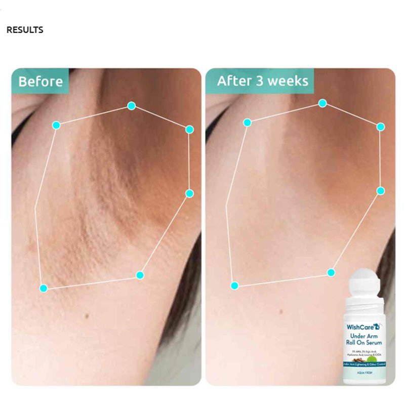 WishCare Under Arm Roll On Serum – 50m - Image 3